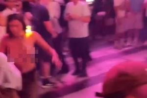 纽约G3赛后惊现女球迷遇袭:上衣被扒头发被烧,情况危急!